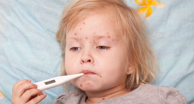 Trẻ Bị Sởi Tắm Lá Gì Mau Khỏi Bệnh - Lưu Ý Mẹ Cần Biết